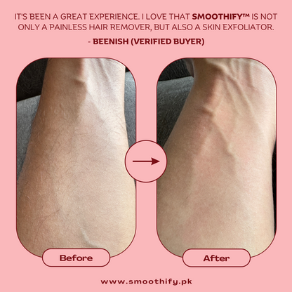 Smoothify™ Painless Hair Remover
